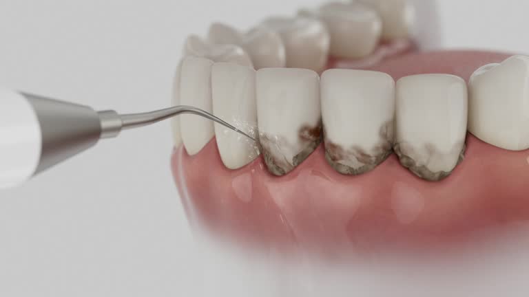 Reliable Teeth Whitening contractor in Escalon, CA by Smile Center Dentistry